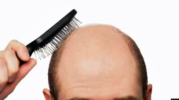 Best products to use for hair loss